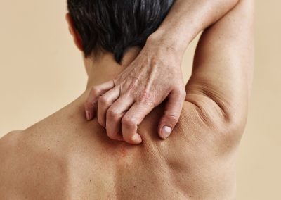 Skin Disorders